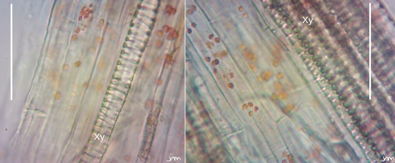 tige cuscute gaine périvasculaire chromoplastes détail