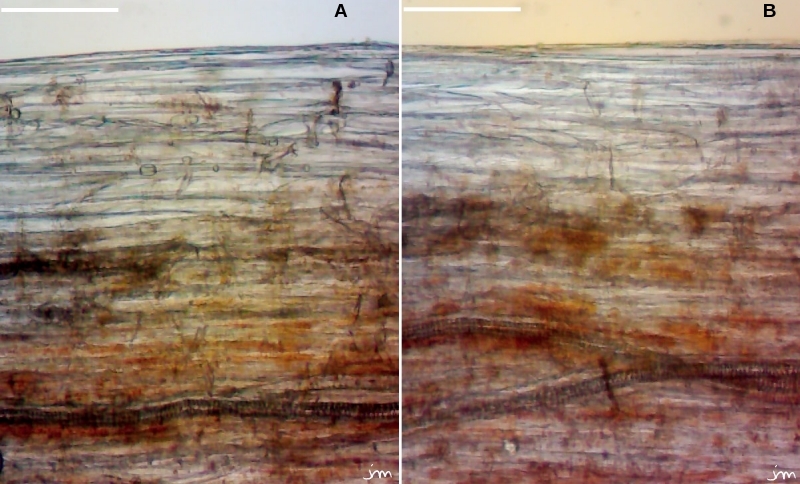 tige cuscute gaine périvasculaire chromoplastes