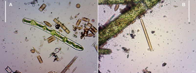 comparaison biodiversité diatomée sorgue