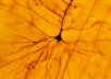 Neurone