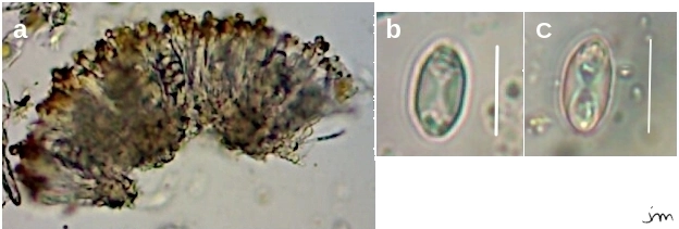 reproduction sexuée xanthoria apothécie ascospore